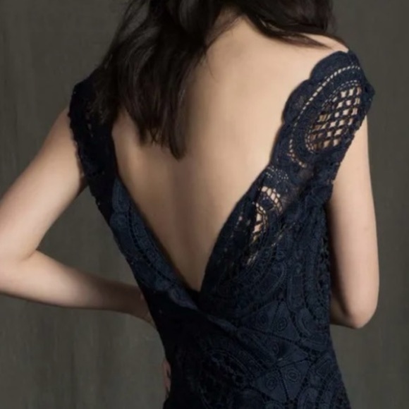 Tracy Reese for Anthropologie Barlion Scalloped Lace Open Back Midi Dress NEW - Picture 3 of 9